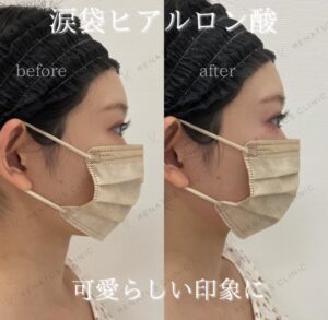 症例写真