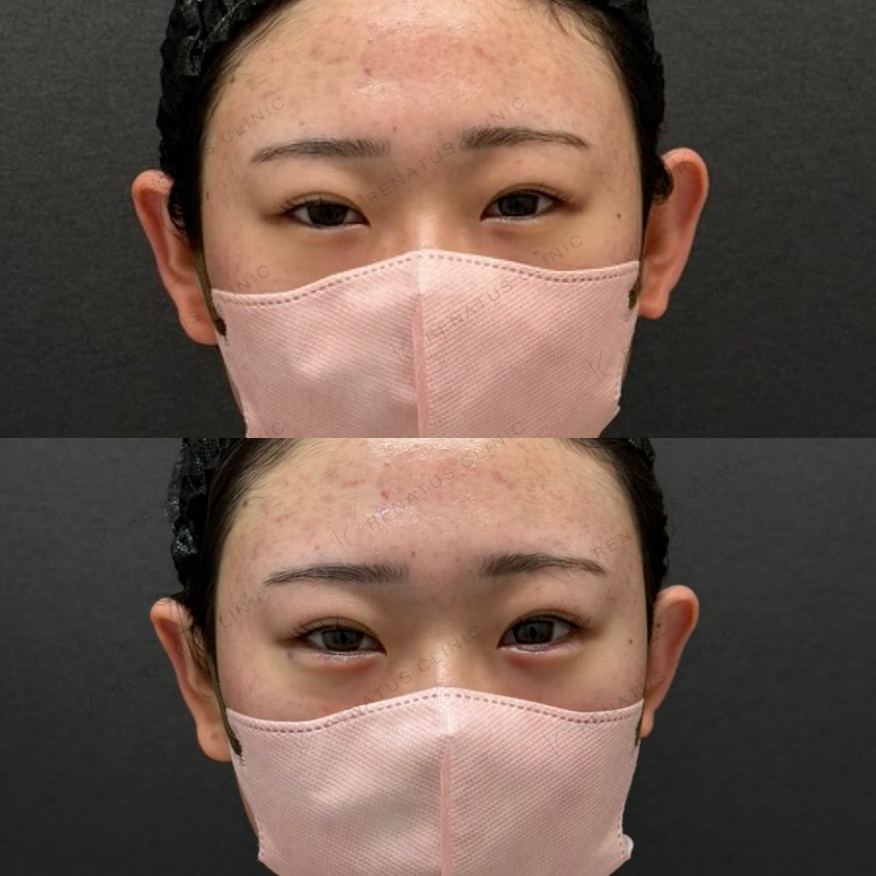 福岡_1041_辻橋Dr_涙袋_ボルベラ_女性_20_正面
