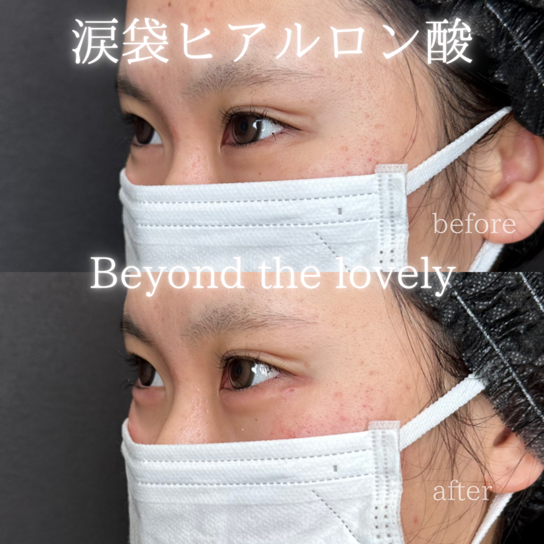 17のコピー