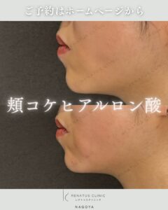 症例写真