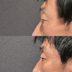 症例写真